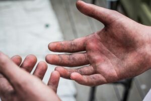 Difference Between OCD Germs And Contamination