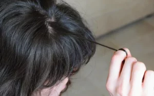 The Best OCD Trichotillomania Treatment